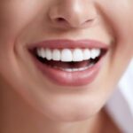 cosmetic_dentistry_Burlington_dentist